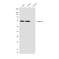 ZAP70 (4B2) Mouse mAb ABZ3965
