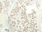 STAT1 (9D6) Mouse mAb ABZ3969