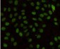 MLH1 (4C1) Mouse mAb ABZ3975