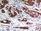 AKT1 (2A1) Mouse mAb ABZ3985