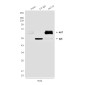 AKT1/2/3 Mouse mAb ABZ3986