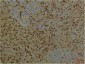 PI3 Kinase p85 alpha (3H5) Mouse mAb ABZ3995