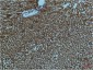 PI3 Kinase p85 alpha (1C8) Mouse mAb ABZ3996
