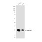 Galectin 3 (7G9) Mouse mAb ABZ4004