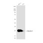 Galectin 3 (7G9) Mouse mAb ABZ4004