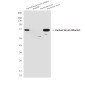 Human Serum Albumin (1A8) Mouse mAb ABZ4018