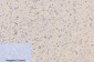 CD4 (7H9) Mouse mAb ABZ4028
