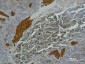 IL-2 Receptor alpha Mouse mAb ABZ4029