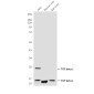 TGF beta 1 (8F6) Mouse mAb ABZ4034