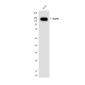 EGFR (1A11) Mouse mAb ABZ4044