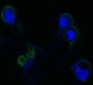 FGFR4 Mouse mAb ABZ4057