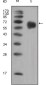 FGFR4 Mouse mAb ABZ4057