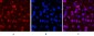 Progesterone Receptor Mouse mAb ABZ4064