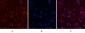 Progesterone Receptor Mouse mAb ABZ4064