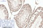 Progesterone Receptor Mouse mAb ABZ4064