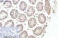 Progesterone Receptor Mouse mAb ABZ4064