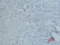 CD10 (7C7) Mouse mAb ABZ4068
