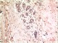 gamma Tubulin (8H4) Mouse mAb ABZ4074
