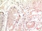 gamma Tubulin (9B5) Mouse mAb ABZ4075
