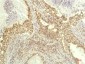S6K1 (3A2) Mouse mAb ABZ4085