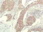 STAT1 (9G8) Mouse mAb ABZ4087