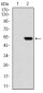 PHC1 (8G5) Mouse mAb ABZ4088