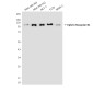 Ephrin Receptor B1 (9B4) Mouse mAb ABZ4092