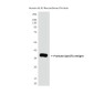 Prostate Specific Antigen Mouse mAb ABZ4095