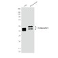 Cytokeratin 8 (10A5) Mouse mAb ABZ4096