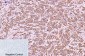 Cytokeratin 6 (1A5) Mouse mAb ABZ4097