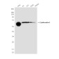 Cytokeratin 6 (1A5) Mouse mAb ABZ4097
