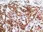 Ubiquitin (7F2) Mouse mAb ABZ4107
