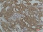 Hsc70 (5C2) Mouse mAb ABZ4112
