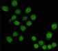 TBL1X (4H2) Mouse mAb ABZ4146