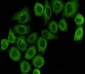 Pyruvate Dehydrogenase E1 alpha (3H2) Mouse mAb ABZ4150