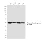 Pyruvate Dehydrogenase E1 alpha (3H2) Mouse mAb ABZ4150