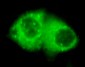 Cytokeratin 7 (4G9) Mouse mAb ABZ4151