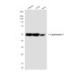 Cytokeratin 7 (4G9) Mouse mAb ABZ4151