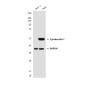 Cytokeratin 7 (4G9) Mouse mAb ABZ4151