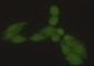 Hsp70 1A(2D4) Mouse mAb ABZ4152