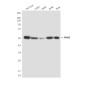 PKM2 (1F2) Mouse mAb ABZ4167