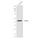 CKMT2 (3F4) Mouse mAb ABZ4171