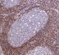 CD44 Mouse mAb ABZ4178