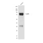 CD44 Mouse mAb ABZ4178