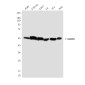 ALDH2 Mouse mAb ABZ4179