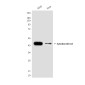 Cytokeratin 18 (6A8) Mouse mAb ABZ4214