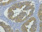 Cytokeratin 19  Mouse mAb ABZ4216