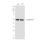 Cytokeratin 7 (9G9) Mouse mAb ABZ4217