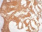 Cytokeratin 16/K16 Mouse mAb ABZ4218
