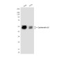 Cytokeratin 16/K16 Mouse mAb ABZ4218